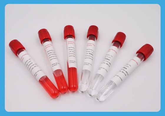 5ml het speciale Ethyleenoxide van de de Inzamelingsbuis van de Draadsteekproef