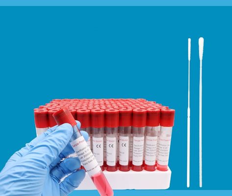 De medische ABS Weerstand van het de Buizen ultra Hoge Effect van het Bloedspecimen