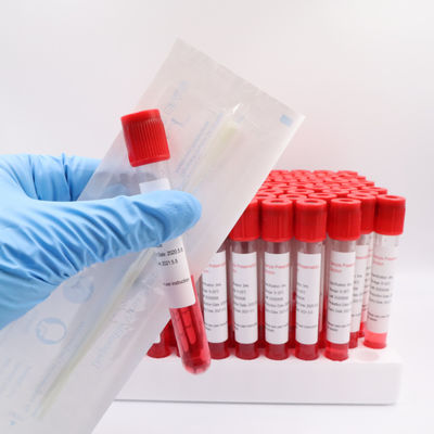 van de het Bloedinzameling van 1.5ml 2ml  de Buizen Beschikbaar Virus
